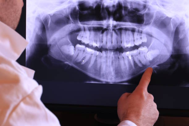 Best Emergency Tooth Extraction in Preston, TX