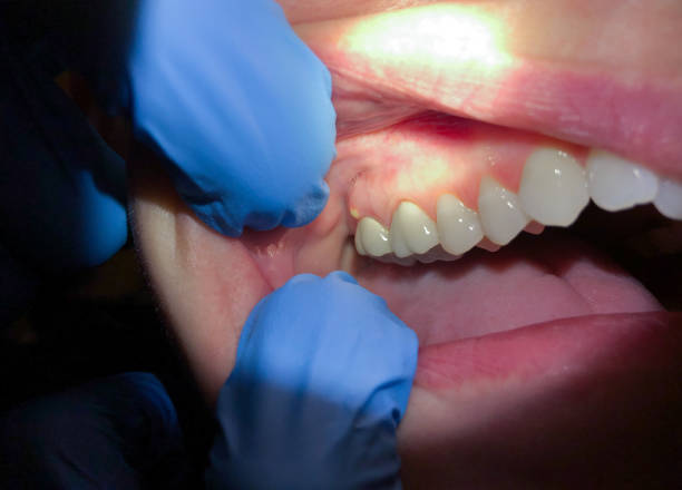 Best Emergency Orthodontic Repairs in Preston, TX