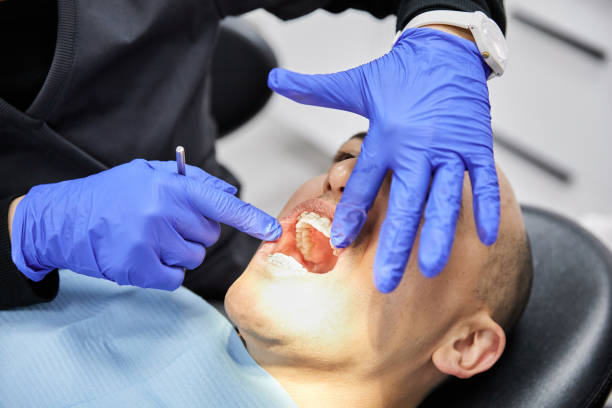 Best Emergency Dental Surgery in Preston, TX